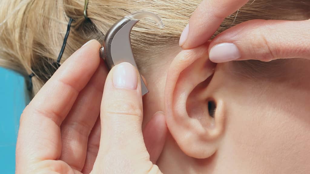 appareil auditif invisible : contours d'oreille BTE