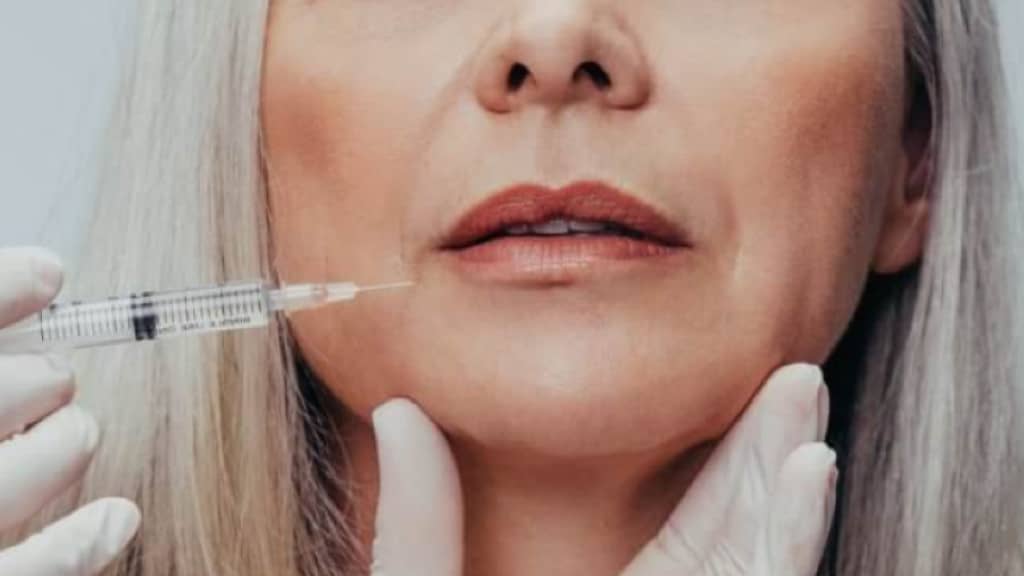 Injections d’acide hyaluronique : chirurgie esthétique pour masquer les rides du visage