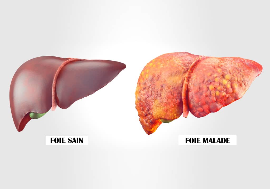 Comment les Gamma GT témoignent de la santé du foie ?