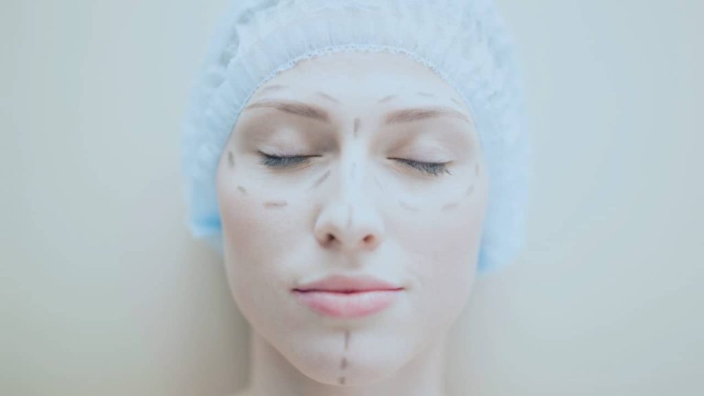 chirurgie esthétique faciale