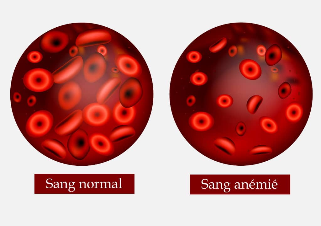 Comment se présente le sang anémié ?