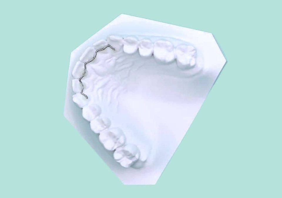 Appareil Orthodontique Dents Trainer T4K Pour Enfants - Alignement Dentaire - Neuf (MPN: E6D1-81147)