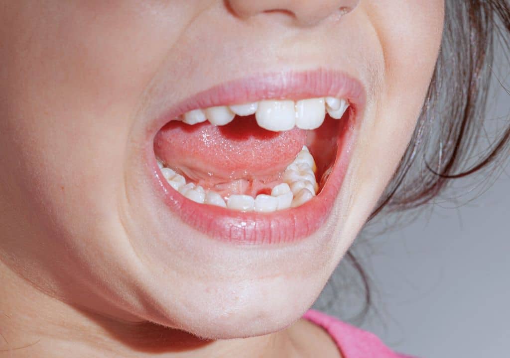 Pour quels soins dentaires opter pour rendre le sourire plus esthétique ?
